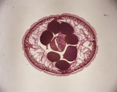 gusano microscopio